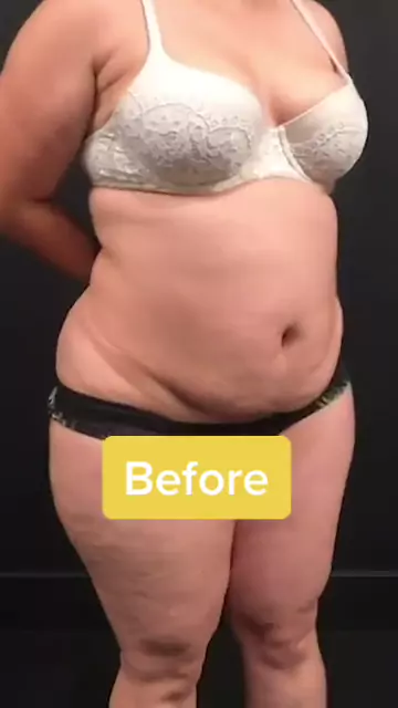 mondragon tits & dr mondragon breast sizeDiscoveKwai