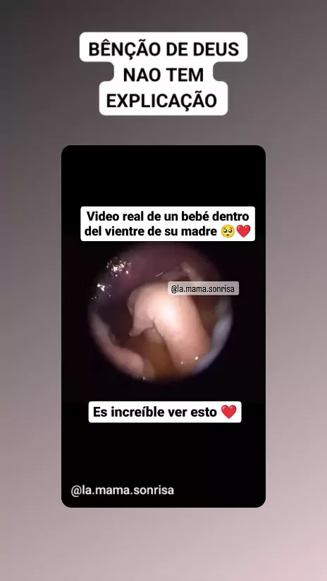 madre e hijo real & real incesto madre hijo| Disco ...| Kwai
