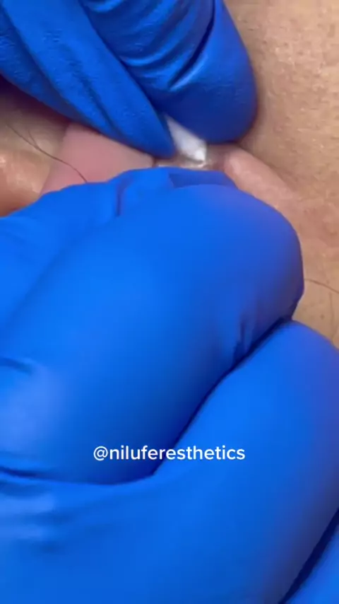 leah sthetics & leahsthetics| Discover