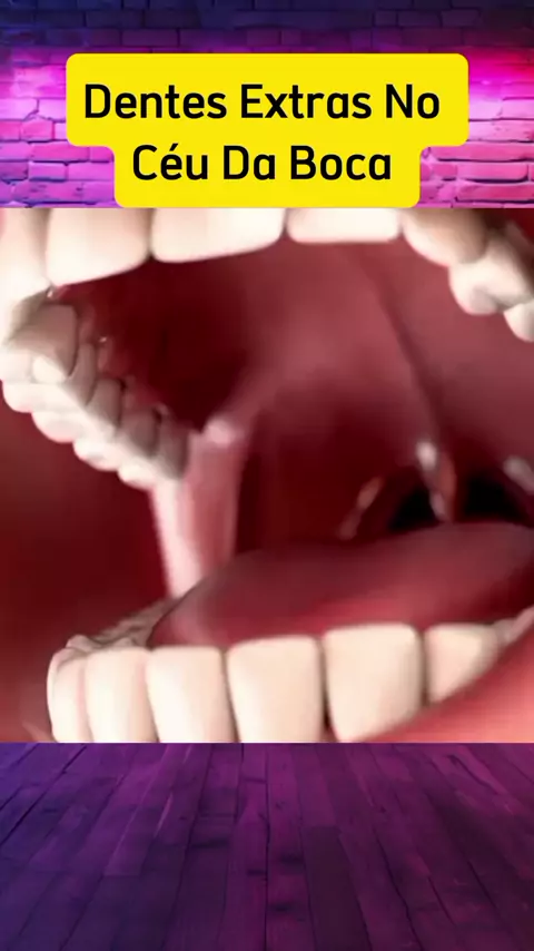 dente nascendo no ceu da boca: